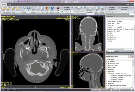 ) and offers several fast and intuitive tools. . Dicom viewer download